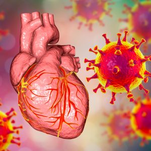 Vaccinated People Have Fewer Cardiac Events after COVID-19