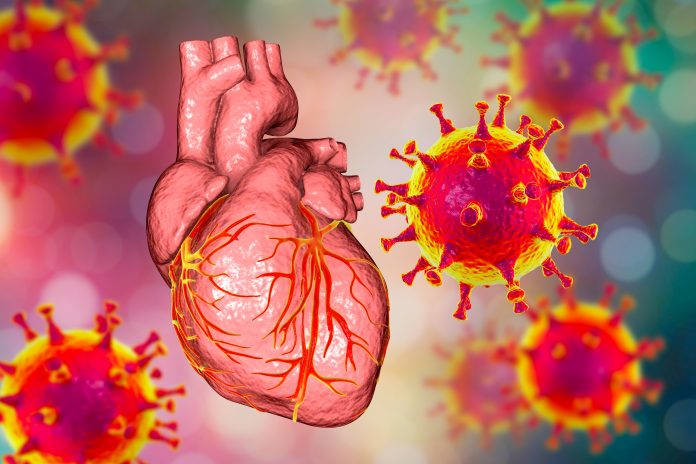 An illustration of SARS-CoV-2 virus particles next to a diseased looking heart, to represent cardiovascular complications after COVID-19