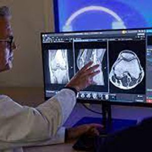 How Artificial Intelligence Is Driving Changes in Radiology