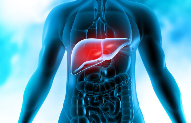 Illustration of a man's torso and arms with his liver highlighted in red to indicate acute liver failure