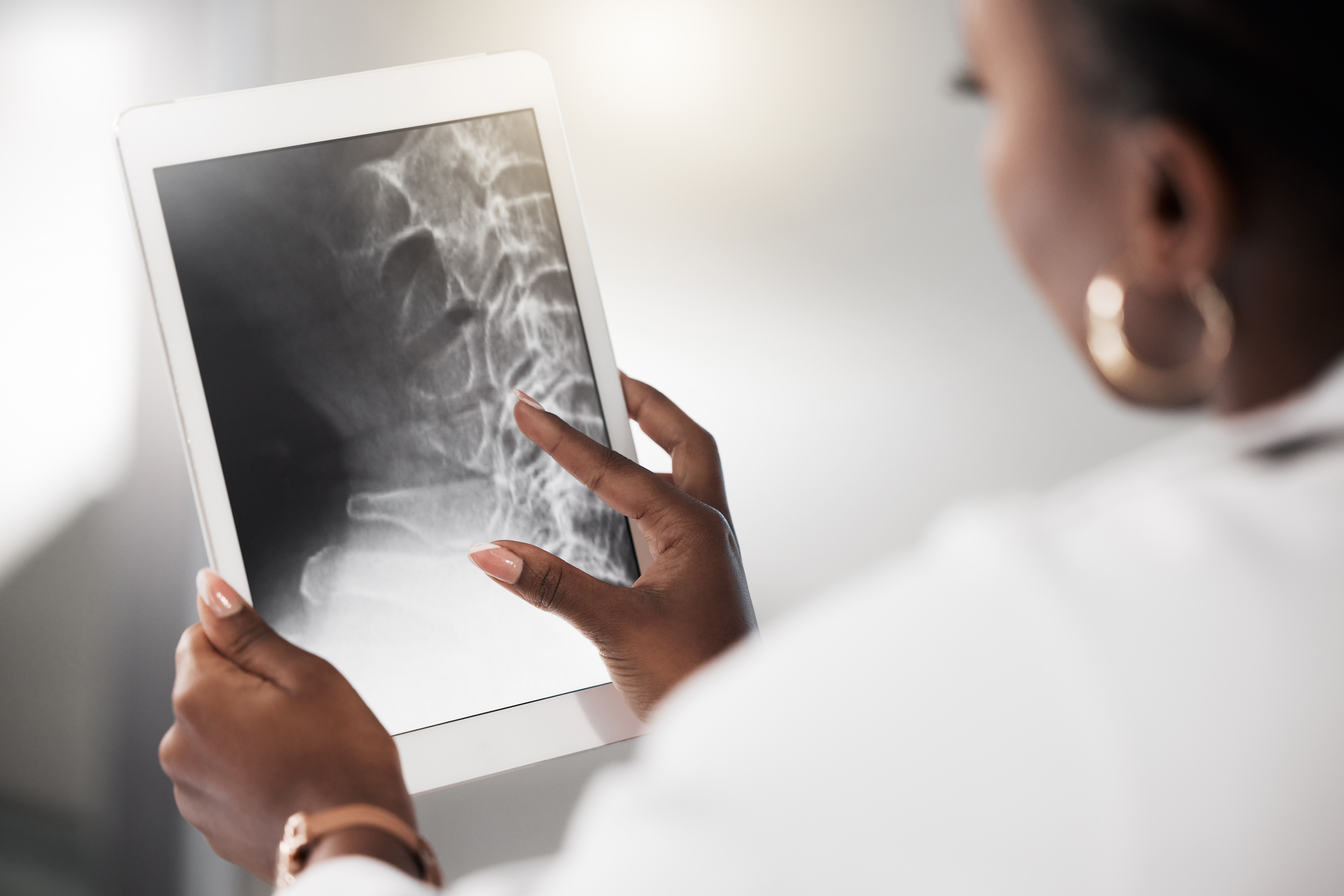 Shot of a Black, female doctor analysing a spine X-ray on the screen of a digital tablet to look for signs of osteoporosis