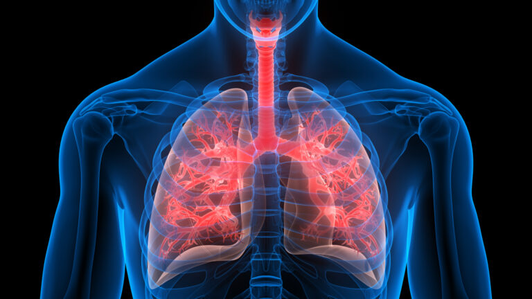 Miniature Robots Could Treat Tumors Deep within the Lung