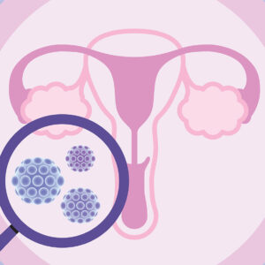 HPV Testing and Genotyping for Cervical Cancer Screening