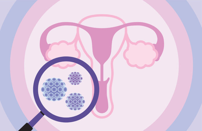 HPV, cervical cancer