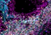 Lung Cell Atlas Created