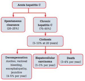 Natural history of hepatitis C virus chart
