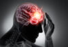 Cardiovascular Disease Risk May Be Increased by Traumatic Brain Injury