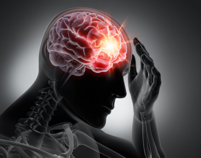Headache, conceptual 3d illustration, autoimmune encephalitis, brain inflammation, Credit: peterschreiber.media/Getty Images