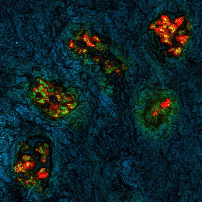 Novel imaging technique cancer cells versus normal cells
