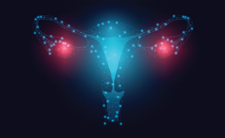 AI and ovarian cancer