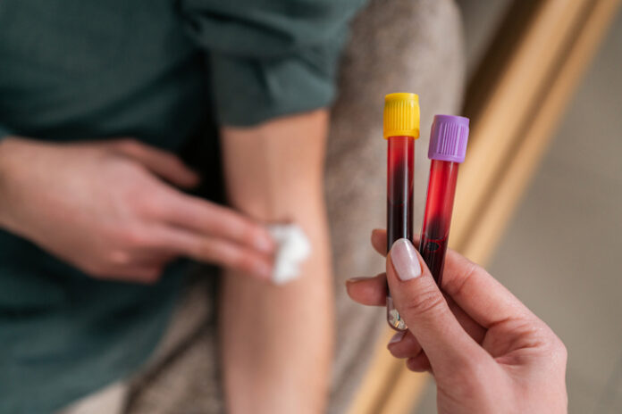 Female nurse holding blood collection tubes for liquid biopsy
