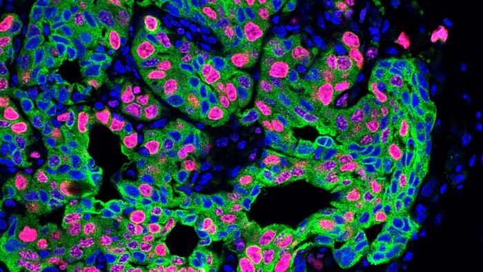 Egeblad_Chronic Stress drives cancer metastasis