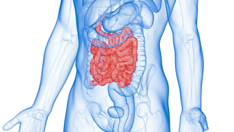 Transparent image of a human torso showing inflamed small intestine, as seen in Crohn's disease patients