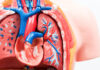 Simple Test Can Rule Out Pulmonary Embolism in Cancer Patients