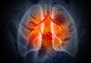 Immunotherapy before and after Surgery Improves Survival in Lung Cancer Patients