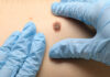 Can BriaCell Beat Merck and Moderna’s Breakthrough Personalized Melanoma Vaccine?