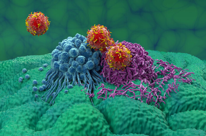 CAR-T cell therapy for stomach cancer, illustration