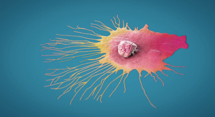 migrating breast cancer cell BRCA cell