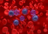 Myeloid Malignancy Testing: Insights from a Portuguese Reference Center Gene therapy for acute myeloid leukemia, conceptual illustration