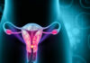 Specific Gut Bacteria Linked to Endometriosis