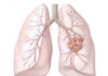 Highly Multiplexed Droplet Digital PCR for Ultra-Sensitive NSCLC Biomarker Detection in Research Workflows