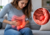 Single-Cell Analysis Reveals Distinct Biology of Early-Onset Colorectal Cancer