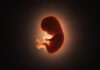 Worlds Apart: Genomics Experts Still Split on Newborn Sequencing Guidelines