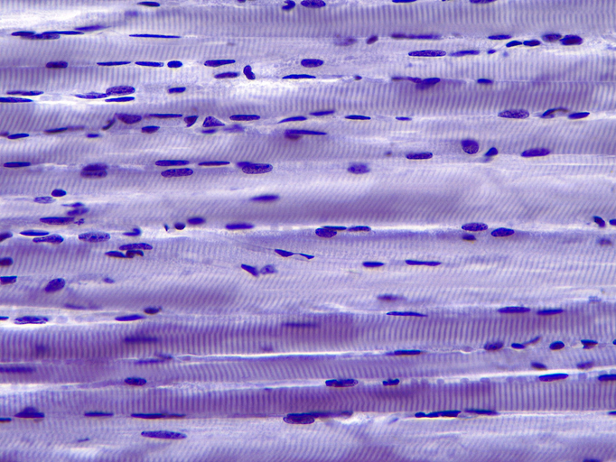 1168911942 Skeletal Muscle Fibres Longitudinal Section,40x light micrograph