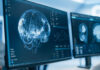 Beyond Detection: Rethinking Radiology in the Age of AI