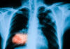 Radiology’s New Frontier  Is the Workflow